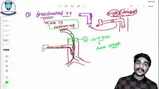 TRACHEOSTOMY TUBE By Hemendra sir