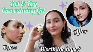 Dot And Key Cica Calming Gel | Is it worth the Hype👀| Khushi Mahla |#dotandkey #skincare