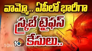 Whammo.. Huge scrub typhus cases in AP.. | Scrub Typhus Cases Increasing In AP | 10TV Life