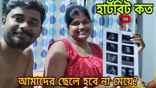 আমার বাচ্চার হার্টবিট কত? আমার ছেলে হবে না মেয়ে?? @AmarChottoAsha 