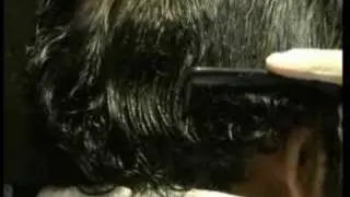 C2G Hair Transplant Video Demo-live surgery with Dr. Cole