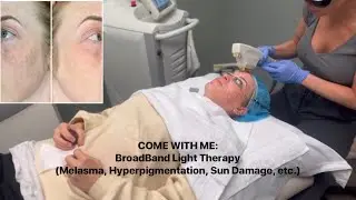 COME WITH ME: BroadBand Light Therapy (Melasma, Hyperpigmentation, Sun Damage, etc.)