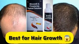 Best Minoxidil For Hair Regrowth | Coverit Plus Spray | Best Minoxidil Finasteride Topical Solution