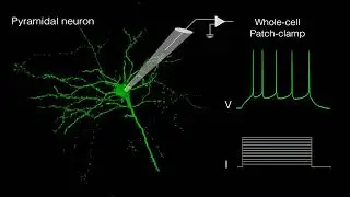 Whole-cell patch clamp