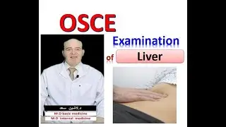 Liver clinical examination OSCE