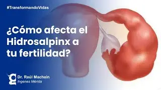 ¿Qué es Hidrosalpinx?: Causas, Diagnóstico y Tratamientos | Ingenes