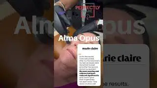 Alma Opus Treatment  #tampamedspa