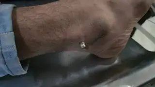 रीवा। युवक के पाव की एड़ी में धसी गोली, आ रही नजर युवक ने तीन लोगों पर लगाए गंभीर आरोप,