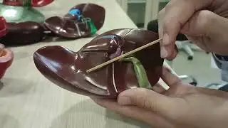 Liver,Biliary tree, Ligaments,porta hepatis