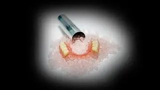 Glamory dental empty dental cartridges aluminium tubes for Flexible Thermoplastic Denture Materials