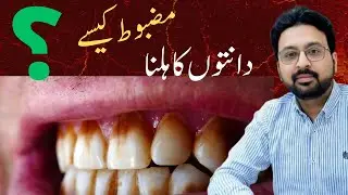 Loose Teeth Treatment at Home | Can a Loose Tooth Be Saved? Dentist Explains