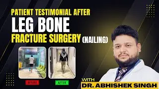 Recovery Journey of a 4-Piece Leg bone Fracture (1 vs. 3 Months)