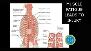 Muscle Fatigue Leads to Injury