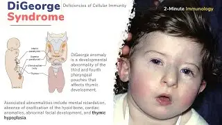 Immunodeficiency diseases session 2