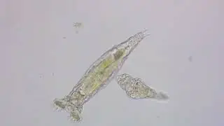 R&auml;dertierchen bei der Arbeit   Mikroskopie / Leben im Wassertropfen