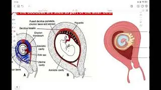 Embryo | decidua and chorion ✅