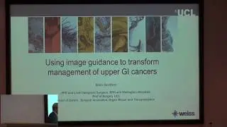 Using image guidance to transform management of upper GI cancers, Brian Davidson, HomSim 2018