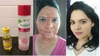 Face Clean Up Using Almond Oil for dry skin|Easy Face Clean Up For teenagers(In Hindi)