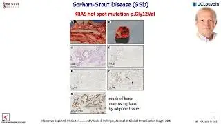 Genetic Causes of GSD