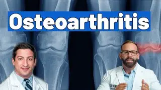 Osteoarthritis Teaching Rounds