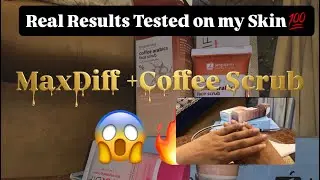I Tried 2 Viral Skincare Products 😱 | Honest Review | Worth It or Not?🐣🥹