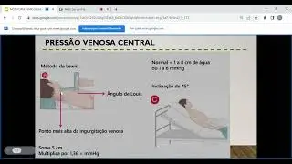 Press&atilde;o Venosa Central
