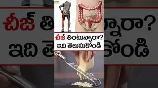 చీజ్ తింటున్నారా? ఇది తెలుసుకోండి #cheese #healthtips #healthyfoods #ytshorts #weightloss #hairloss