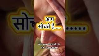 खाने के बाद सिरदर्द? ये signal है ⚠️ | Digestive Headache
