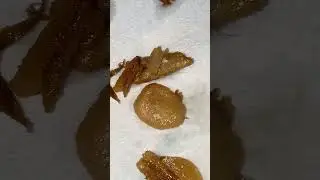 ew fly's egg