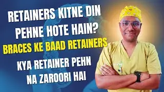 Dr Rudra Mohan | Braces ke Baad Retainers Kitne Din Tak Pehenna Hota Hai? Retainers Zaroori Hai ?