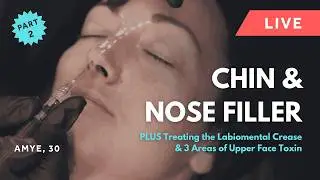 GEM© Clinic 💎 Live Chin & Nose Filler Plus Treating the Labiomental Crease & Upper Face Toxin