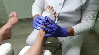 Pedisil Voorvoetkussen & Teenspreider 2in1 (RPSIL0-0199) - by Rodiq Footcare