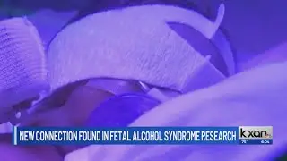 Texas A&M researcher finds link between father's drinking and alcohol-related birth defects
