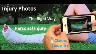How to take Injury Photos for a Personal Injury Claim [Lawyer Tutorial]