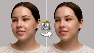 Adobe Photoshop 2025 Tricks: Remove Acne, Smooth Skin with Simple Steps in Minutes
