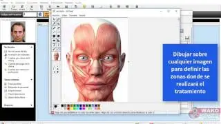 W-Odonto NET,  presentaci&oacute;n m&oacute;dulo de Estetica Dental