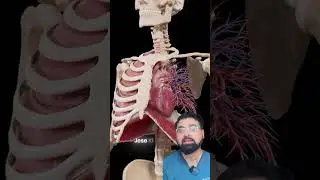 #trending Viral Rib Removal Surgery is One of Those Procedures I Never Recommend as a Doctor #viral