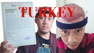HAIR TRANSPLANT IN TURKEY | DAY 1 AFTER  FUE SURGERY  | HAIR TRANSPLANT VLOG | 4,050 GRAFT
