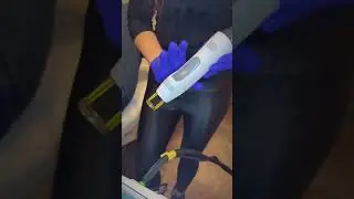 Candela GentleMax Pro in Toronto | Safe & Painless Laser Hair Removal | Ansarian Aesthetic Clinic