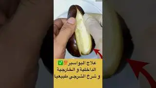 علاج البواسير💯✅ الداخلية و الخارجية  و شرخ الشرجي طبيعيا 👏 مجربة