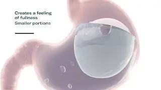 Orthogen Clinic London, Gastric Balloon Weight Loss Program