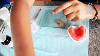 Como Hacer una CUBETA INDIVIDUAL para impresión Dental