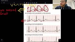 KROK 2 CARDIOLOGY RAPID REVISION