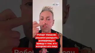 Роберт Минасян решился раскрыть шокирующую правду о том, кто испортил его лицо #шок #сша #glendale