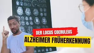 Alzheimer Fr&uuml;herkennung - Blick auf den Locus Coeruleus