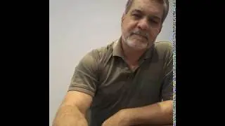 Rinoplastia. Dr. Cecil-  Quebrar ou raspar o dorso nasal ? Faz alguma diferença?#17