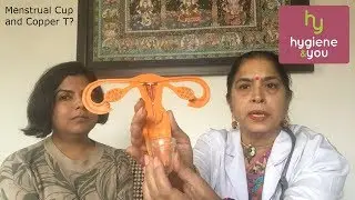 Menstrual cup with copper T / IUD; Doctors Opinion #coppert #contraceptives