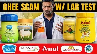 Top 5 Ghee Brands Lab Tested 🧪 | Shocking Adulteration & Safety Results ⚠️😳