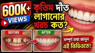 কৃত্রিম  দাঁত লাগানোর খরচ কত || Denture Cost @DentalHealthTips