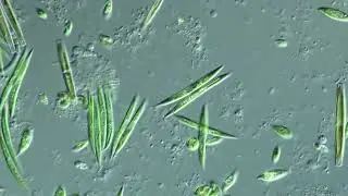 Diatom, Green Algae in DIC, আণুবীক্ষণিক / microscopic creatures created by ALLAH, THE ONLY CREATOR